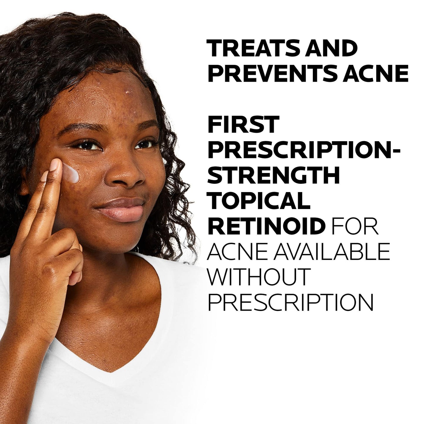 La Roche-Posay Effaclar Adapalene Gel 0.1% Acne Treatment, Retinoid Cream, Acne Medication Gel for Blackheads & Whiteheads, Oil Free, Helps Clear - dailyvitalstore