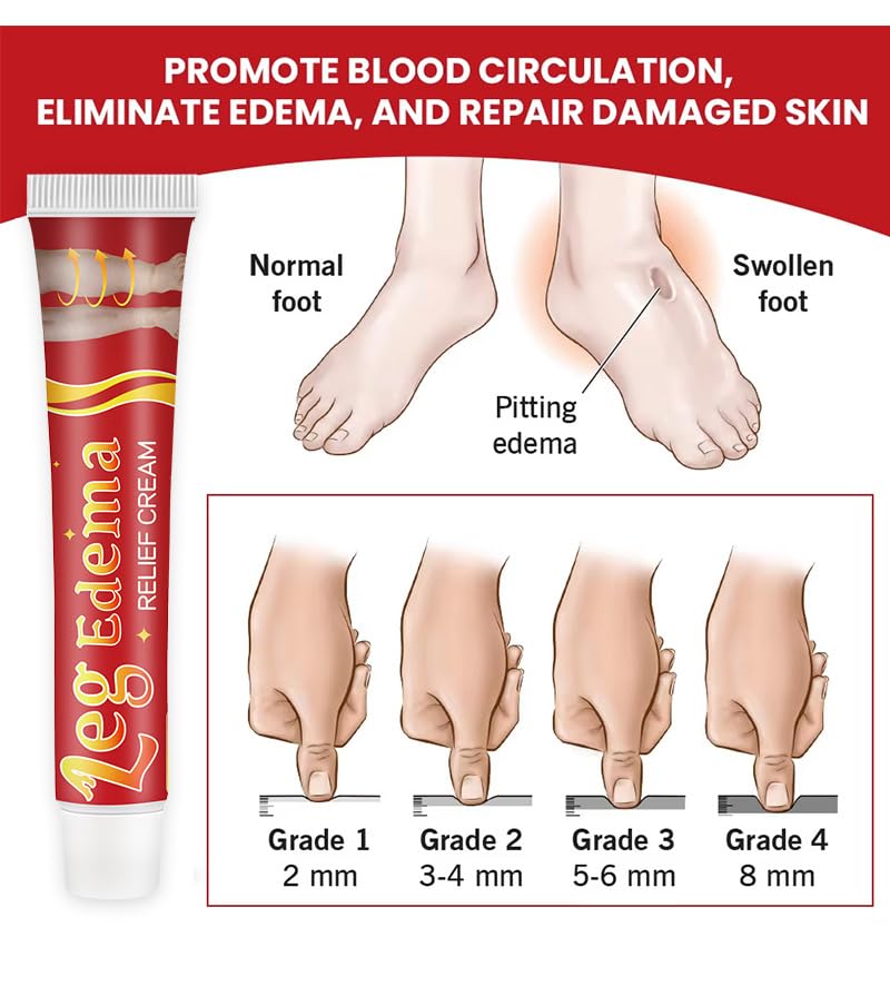 Leg Slimming Massage Cream | Soothing Swelling, Tightening Skin, Auxiliary Care for Reducing Edema （2 Pieces） - dailyvitalstore