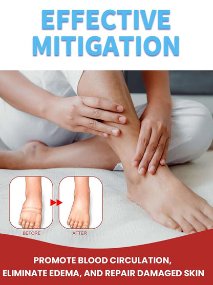 Leg Slimming Massage Cream | Soothing Swelling, Tightening Skin, Auxiliary Care for Reducing Edema （2 Pieces） - dailyvitalstore