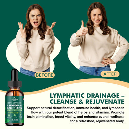 Liposomal Lymphatic Drainage Liquid Drops - Lymphatic Support Supplement with Dandelion Root, Cleavers, Echinacea, Calendula for Immune, Detox Cleanse, Lymph System Support, Lemon Flavor, 2 Fl Oz - dailyvitalstore