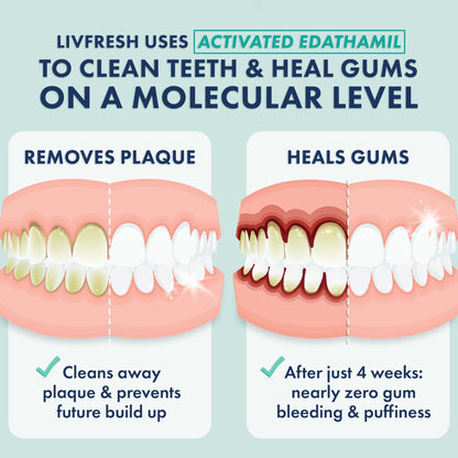 LIVFRESH Toothpaste Gel, Clinically Proven to Remove Plaque 250% Better, Improves Gum Health 190% Better, Prevents & Reduces Tartar - dailyvitalstore