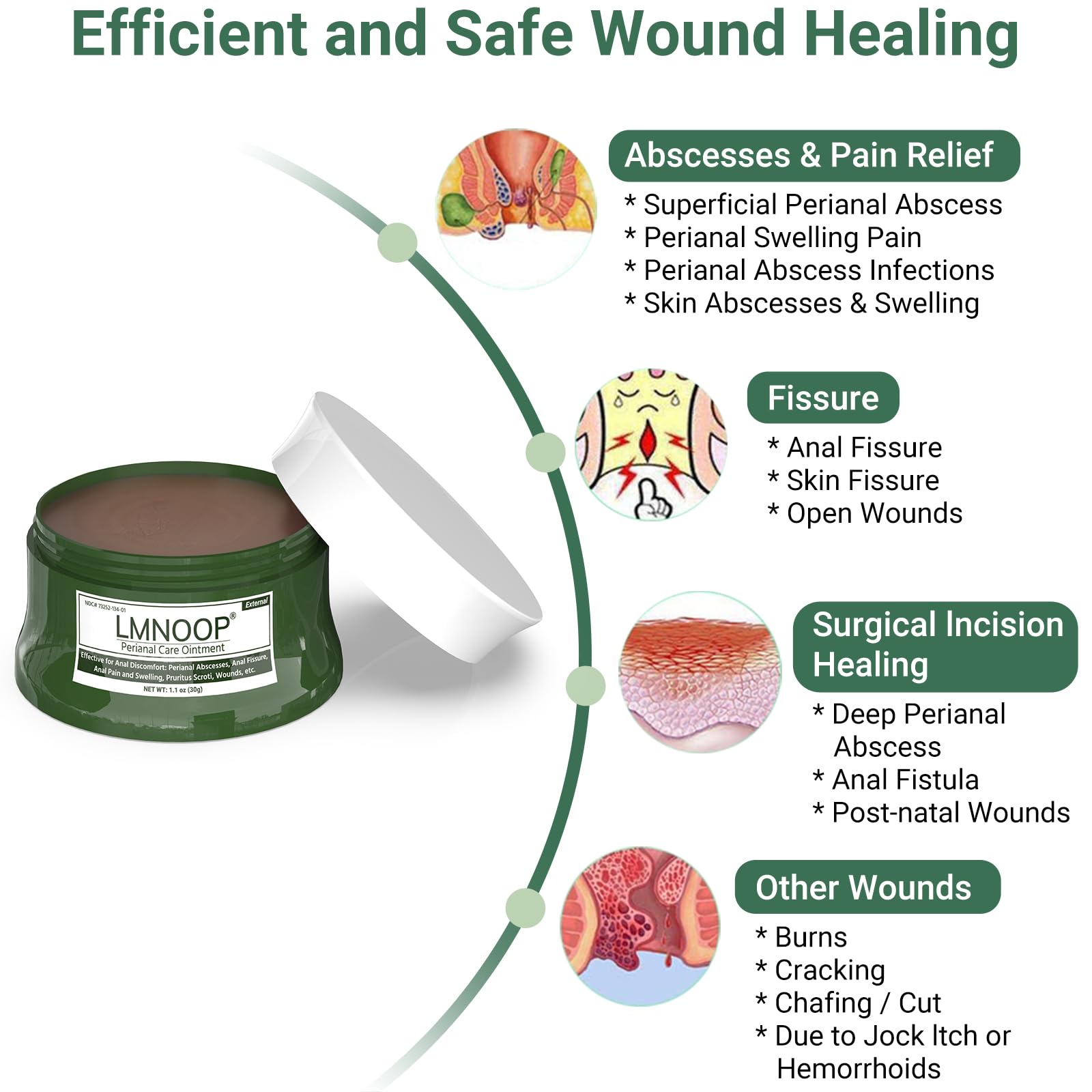 LMNOOP Perianal Repair Ointment: Treatments for Anal Fistula, Anal Fissure, Perianal Abscess, Rapid Relief from Pain, Burning, Itching, Swelling, Bleeding, and Discomfort by Jock Itch or Hemorrhoids - dailyvitalstore