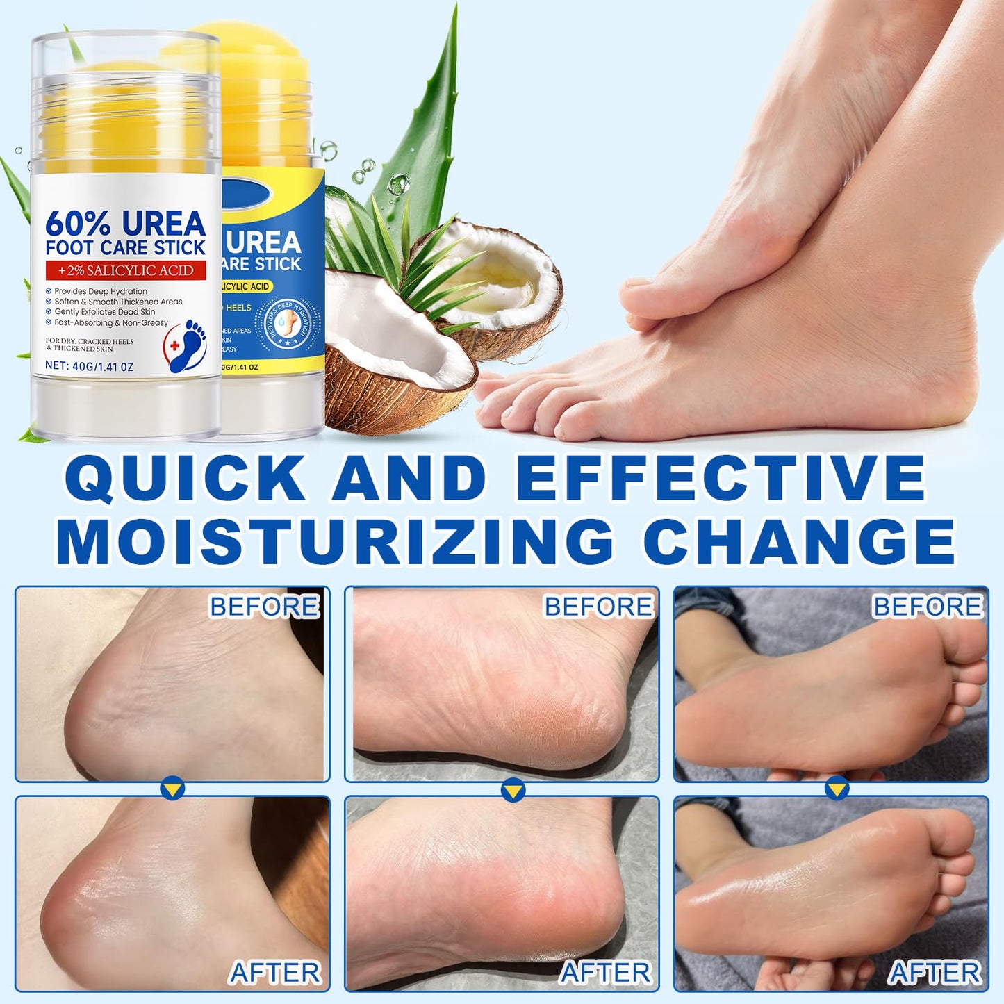 Loobexery 2 Pcs 60% Urea with 2% Salicylic Acid Foot Care Stick, Urea Foot Cream for Cracked Feet, Repairs Dry Rough Heels Fast, Foot Lotion Moisturizer for Dead Skin, Hydrating Heel Balm - dailyvitalstore