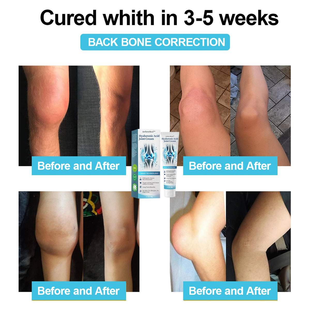 Luhaka ArthroHeal Hyaluronic Acid Joint R-epair Cream,ArthroHeal Joint Cream,Quickly relieve joint discomfort, Quickly relieve joint discomfort, suitable for joint activities throughout the body (1) - dailyvitalstore