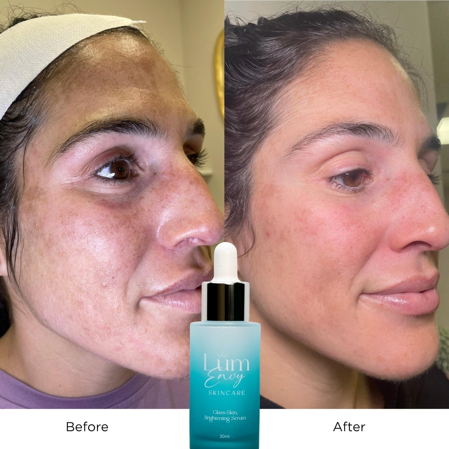 LumEnvy Salmon DNA Glass Skin Serum - Hydrating Korean Skincare Face Serum with PDRN, Niacinamide & Centella Asiatica | Brightening, - dailyvitalstore