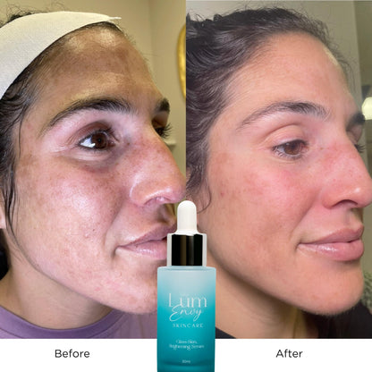 LumEnvy Salmon DNA Glass Skin Serum - Hydrating Korean Skincare Face Serum with PDRN, Niacinamide & Centella Asiatica | Brightening, - dailyvitalstore