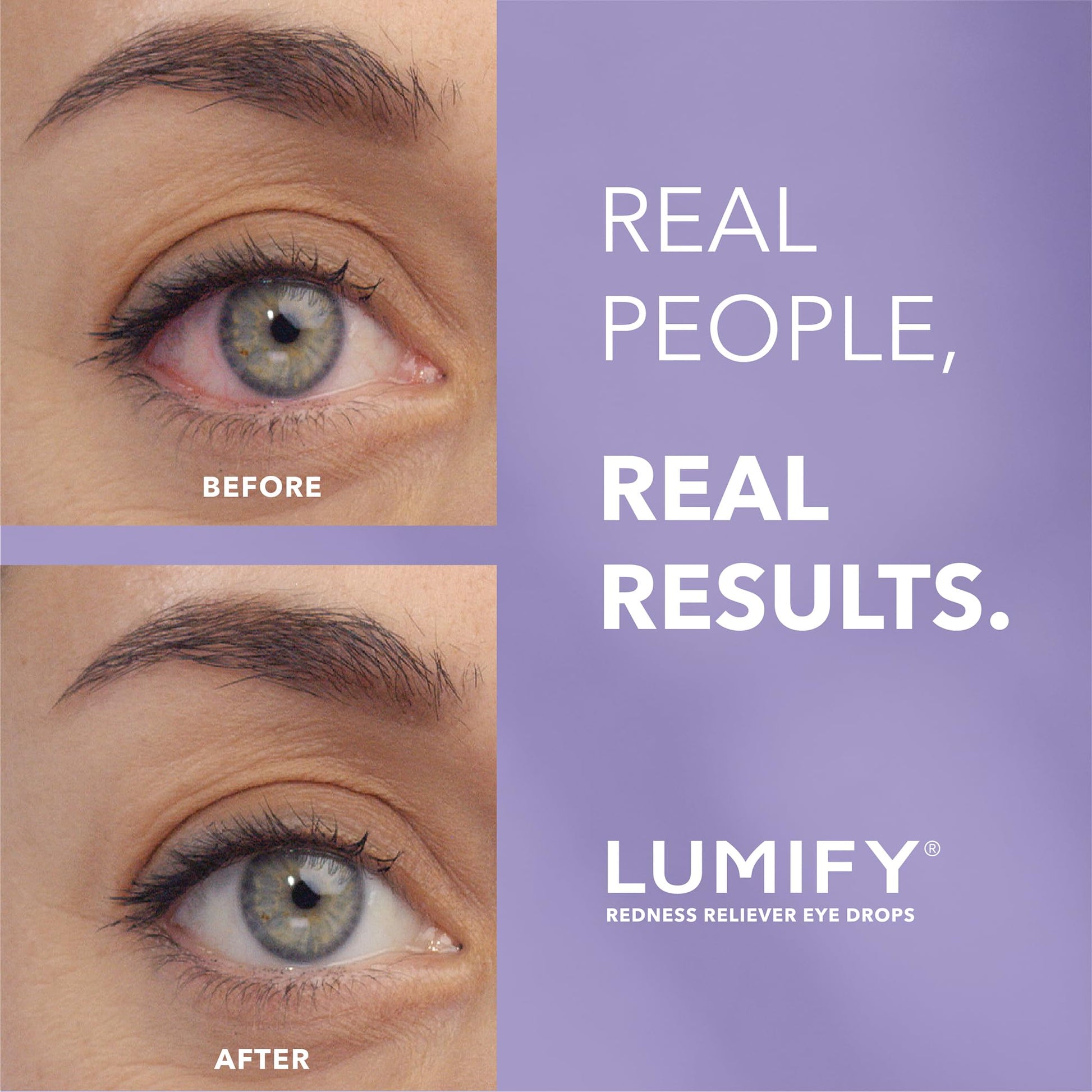LUMIFY Eye Drops for Red Eyes, Redness Reliever for Brighter Looking Eyes, Works in 1 Minute & Lasts Up to 8 Hours, Eye Drops, 0.17 Fl Oz (5 mL) - dailyvitalstore