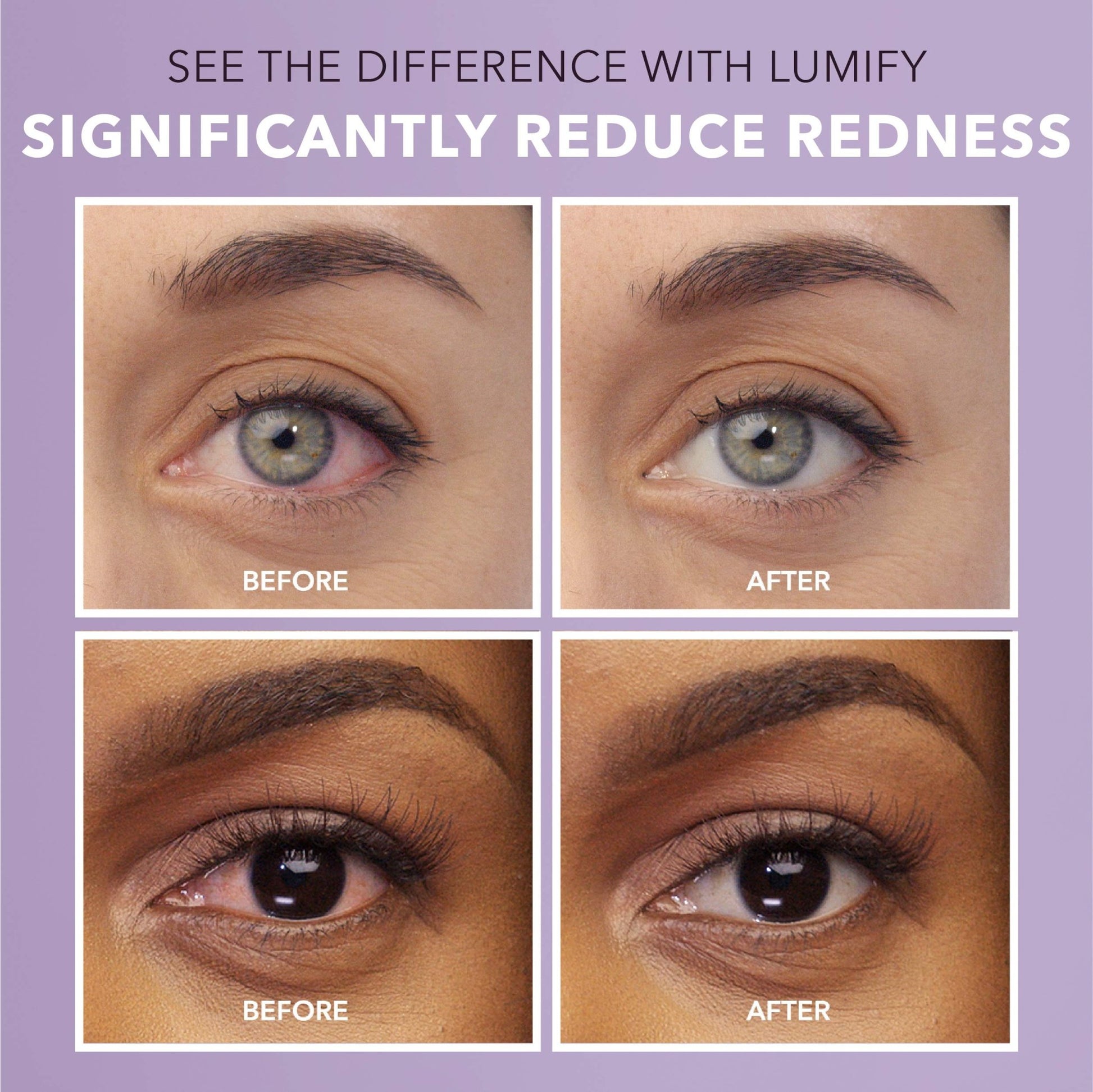 LUMIFY Eye Drops for Red Eyes, Redness Reliever for Brighter Looking Eyes, Works in 1 Minute & Lasts Up to 8 Hours, Eye Drops, 0.25 Fl Oz (7.5mL) - dailyvitalstore