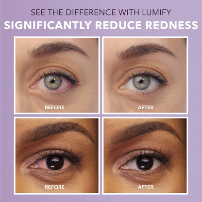 LUMIFY Eye Drops for Red Eyes, Redness Reliever for Brighter Looking Eyes, Works in 1 Minute & Lasts Up to 8 Hours, Eye Drops, 0.25 Fl Oz (7.5mL) - dailyvitalstore