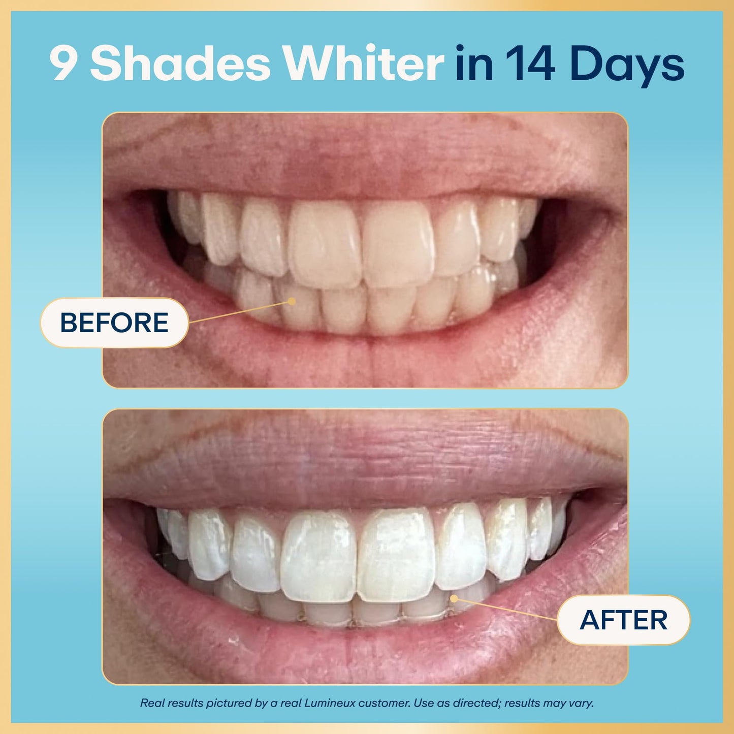 Lumineux Teeth Whitening Strips Kit - 9 Treatments (1 Month) - Peroxide Free - Enamel Safe for Whiter Teeth - Whitening Without The Sensitivity - dailyvitalstore