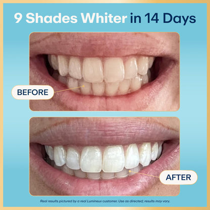 Lumineux Teeth Whitening Strips Kit - 9 Treatments (1 Month) - Peroxide Free - Enamel Safe for Whiter Teeth - Whitening Without The Sensitivity - dailyvitalstore