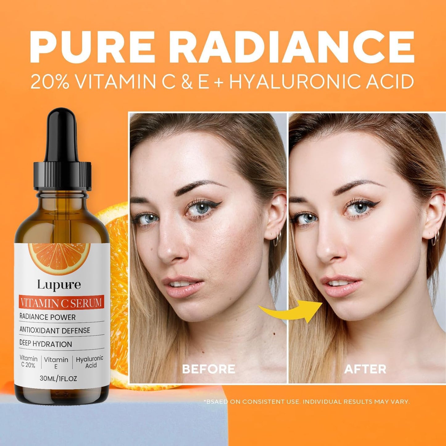 Lupure Professional Vitamin C Face Serum 20%, Anti Aging Facial Super Vit C Serum with Ascorbic Acid Hyaluronic Acid & Vitamin E for Dark Spots, - dailyvitalstore