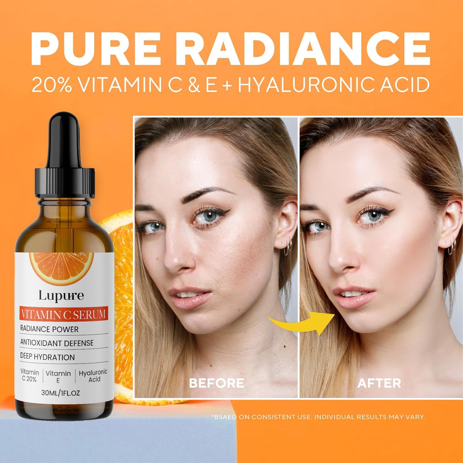 Lupure Professional Vitamin C Face Serum 20%, Anti Aging Facial Super Vit C Serum with Ascorbic Acid Hyaluronic Acid & Vitamin E for Dark Spots, - dailyvitalstore