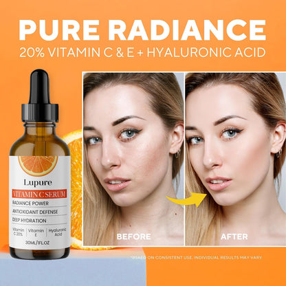 Lupure Professional Vitamin C Face Serum 20%, Anti Aging Facial Super Vit C Serum with Ascorbic Acid Hyaluronic Acid & Vitamin E for Dark Spots, - dailyvitalstore