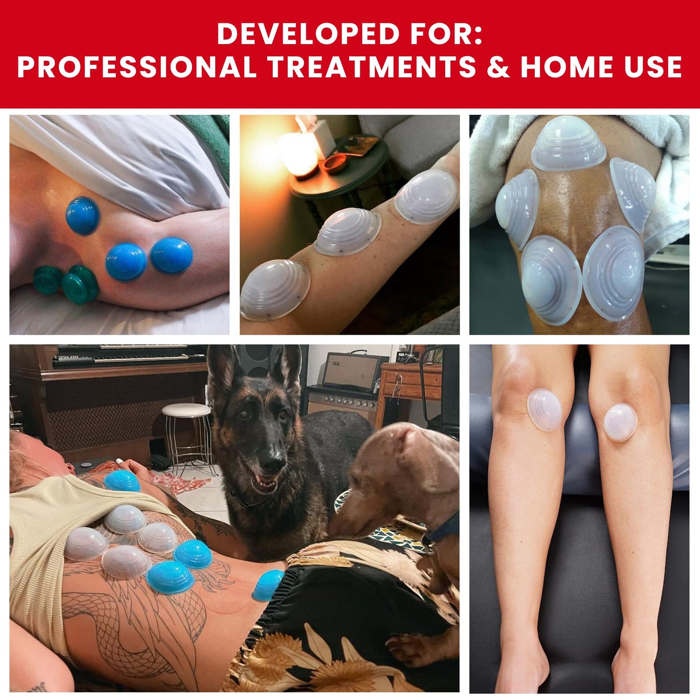 Lure Essentials Cupping Therapy Set 10 Professional Silicone Cupping Cups for Muscle Knots, Joints, Muscles, Arms and Feet - dailyvitalstore