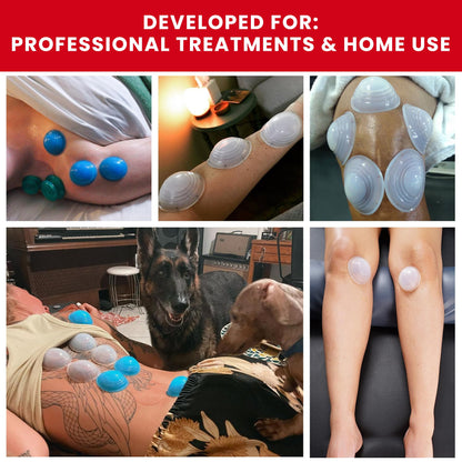 Lure Essentials Cupping Therapy Set 10 Professional Silicone Cupping Cups for Muscle Knots, Joints, Muscles, Arms and Feet - dailyvitalstore