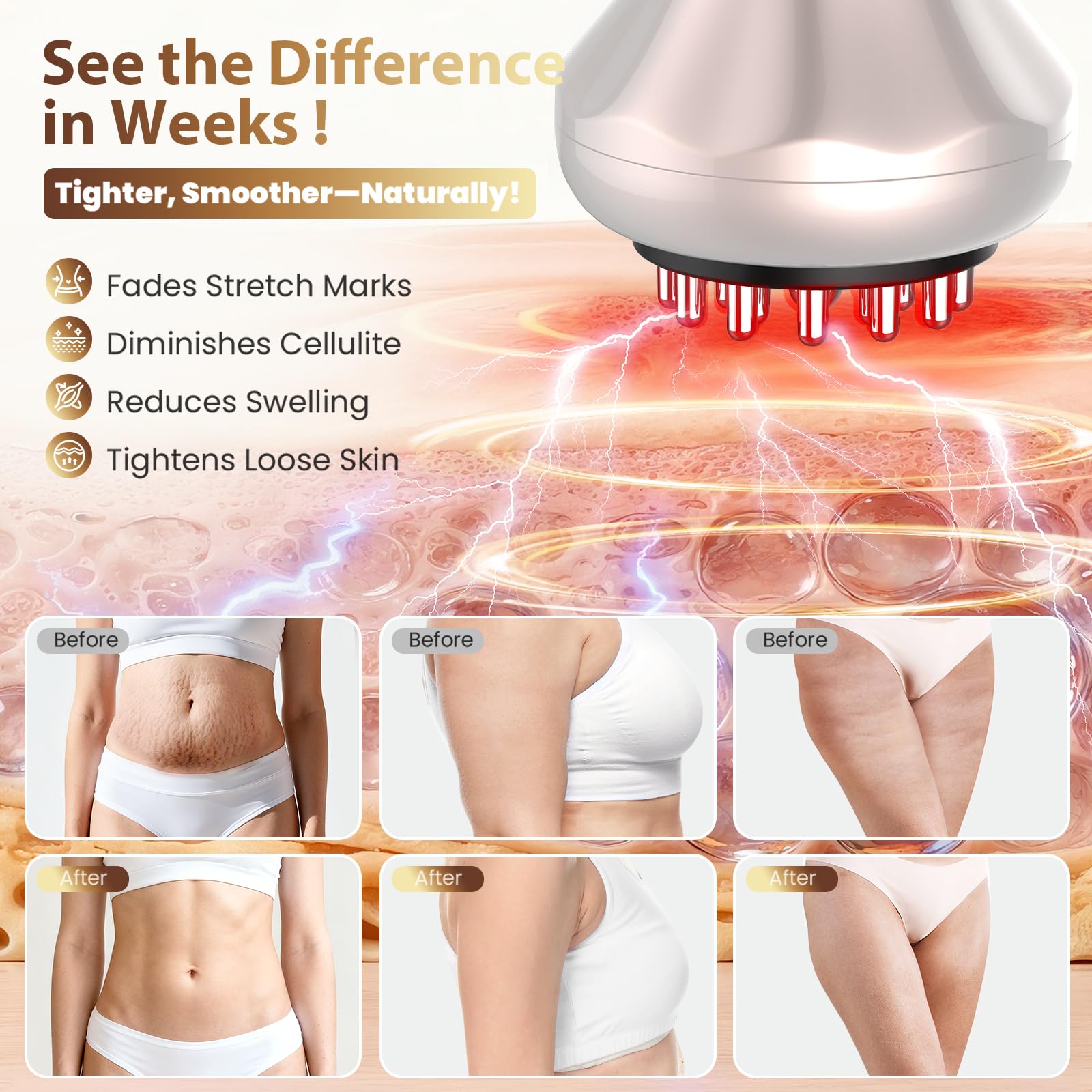 Lymphatic Drainage Massager, Anti Cellulite Massage Tool For Belly & Thigh Stretch Marks & Cellulite Reduction, Handheld Massage tools for Sciatica Nerve, shoulder, Hip, Muscle, Low Back Pain Relief - dailyvitalstore
