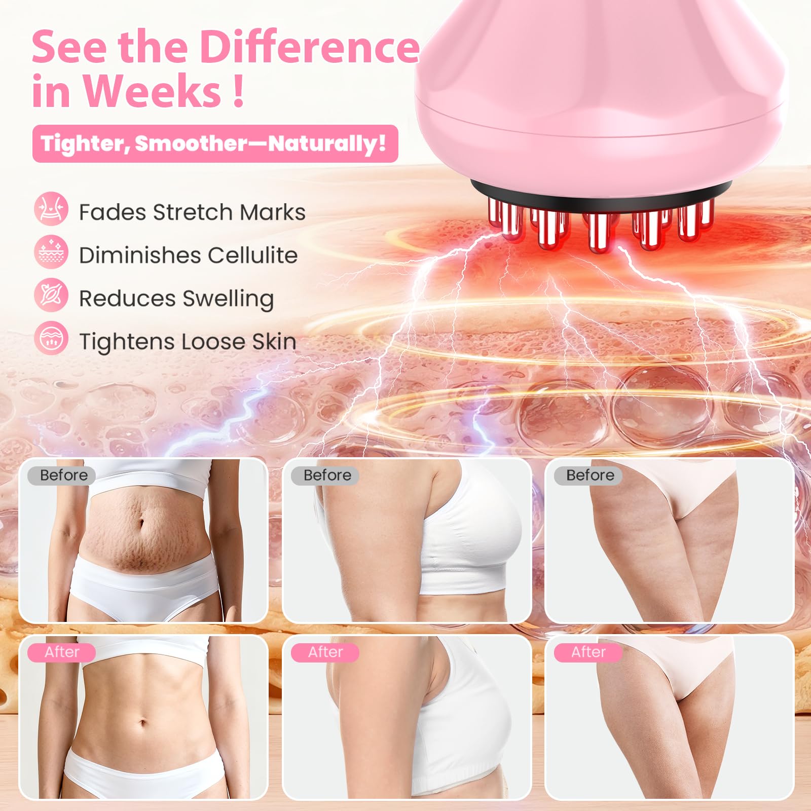 Lymphatic Drainage Massager, Anti Cellulite Massage Tool For Thigh & Belly Stretch Marks & Cellulite Reduction, Handheld Massage tools for Sciatica Nerve, Legs, Arms, Hip, Muscle, Low Back Pain Relief - dailyvitalstore