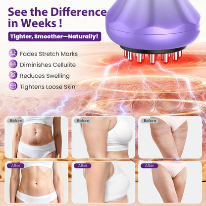 Lymphatic Drainage Massager, Anti Cellulite Massage Tool For Thigh & Belly Stretch Marks & Cellulite Reduction, Handheld Massage tools for Sciatica Nerve, Legs, Arms, Hip, Muscle, Low Back Pain Relief - dailyvitalstore