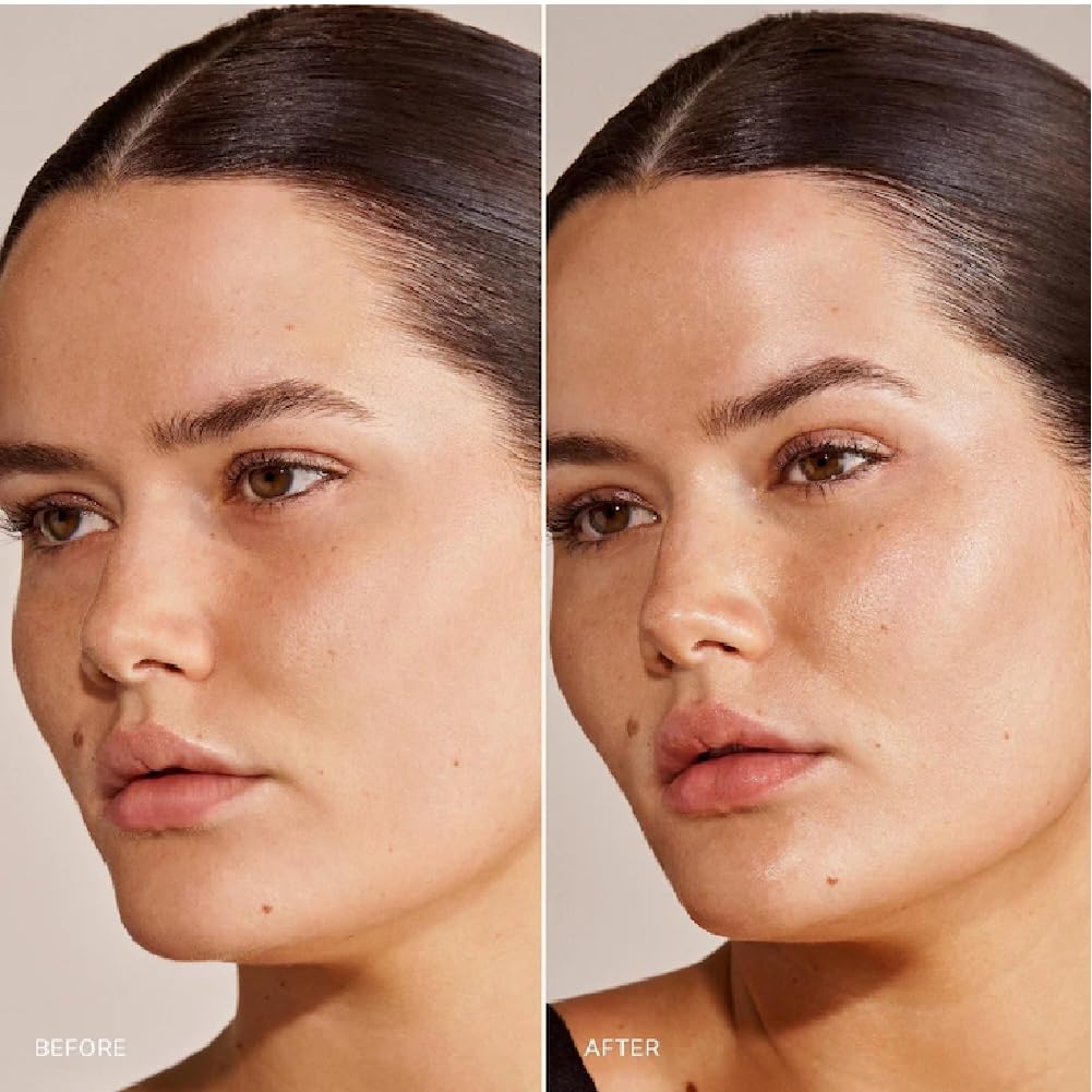 M Great Skin Instant Glow Serum with Niacinamide and Hyaluronic Acid (1.69 oz / 50 ml) + Bonus Acne Patch (36 Pieces) Tea Tree Oil Facial Water Gel - dailyvitalstore