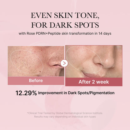 medicube PDRN Toner Rose PDRN Peptide Toner | Lightweight & Watery Type for Skin Boosting, Soothing and Calming, Uneven Skin Tone | with Rose, Peptide, Niacinamide | Korean Skincare, 8.45 fl.oz - dailyvitalstore