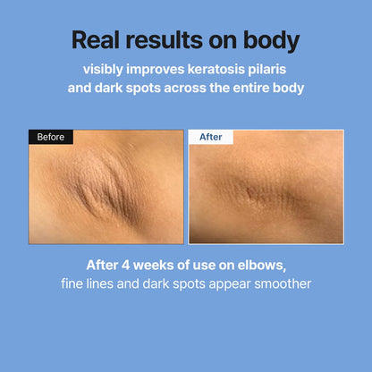 MEDITHERAPY Retinal Skin Booster Serum | Retinaldehyde, Niacinamide Anti-Aging Serum - K-Beauty Facial Serum for Fine Lines, Firming & Radiance - dailyvitalstore