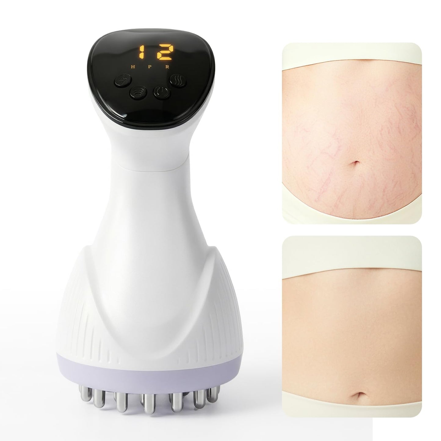 MMGJMP Lymphatic Drainage Massager & Anti-Cellulite Massage Tool, Body Contouring Device for Legs, Arms & Stomach, Supports Smoother Skin, with Gentle Warming & Vibration - W - dailyvitalstore