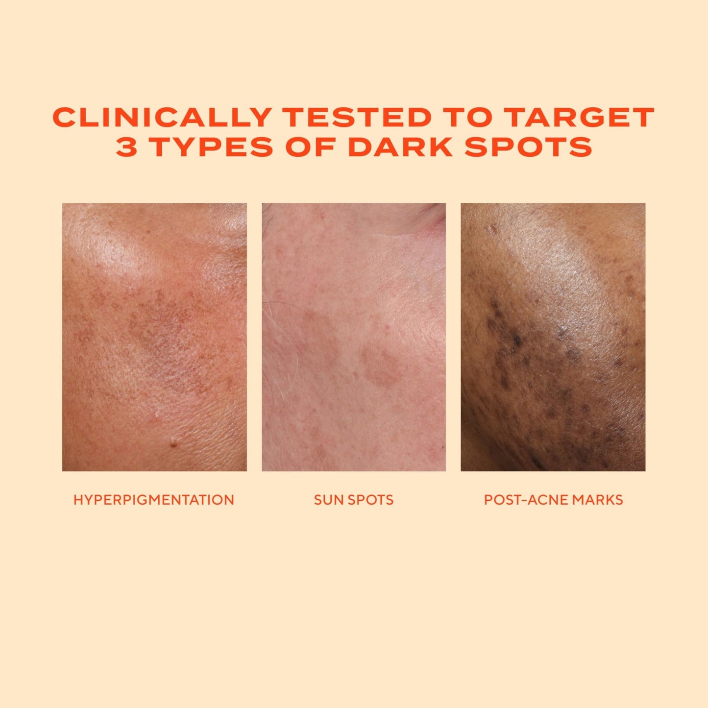 Murad Rapid Dark Spot Correcting Serum - Advanced Anti-Aging Formula with Patented Resorcinol Technology, Tranexamic and Glycolic Acids for Hyperpigmentation - dailyvitalstore