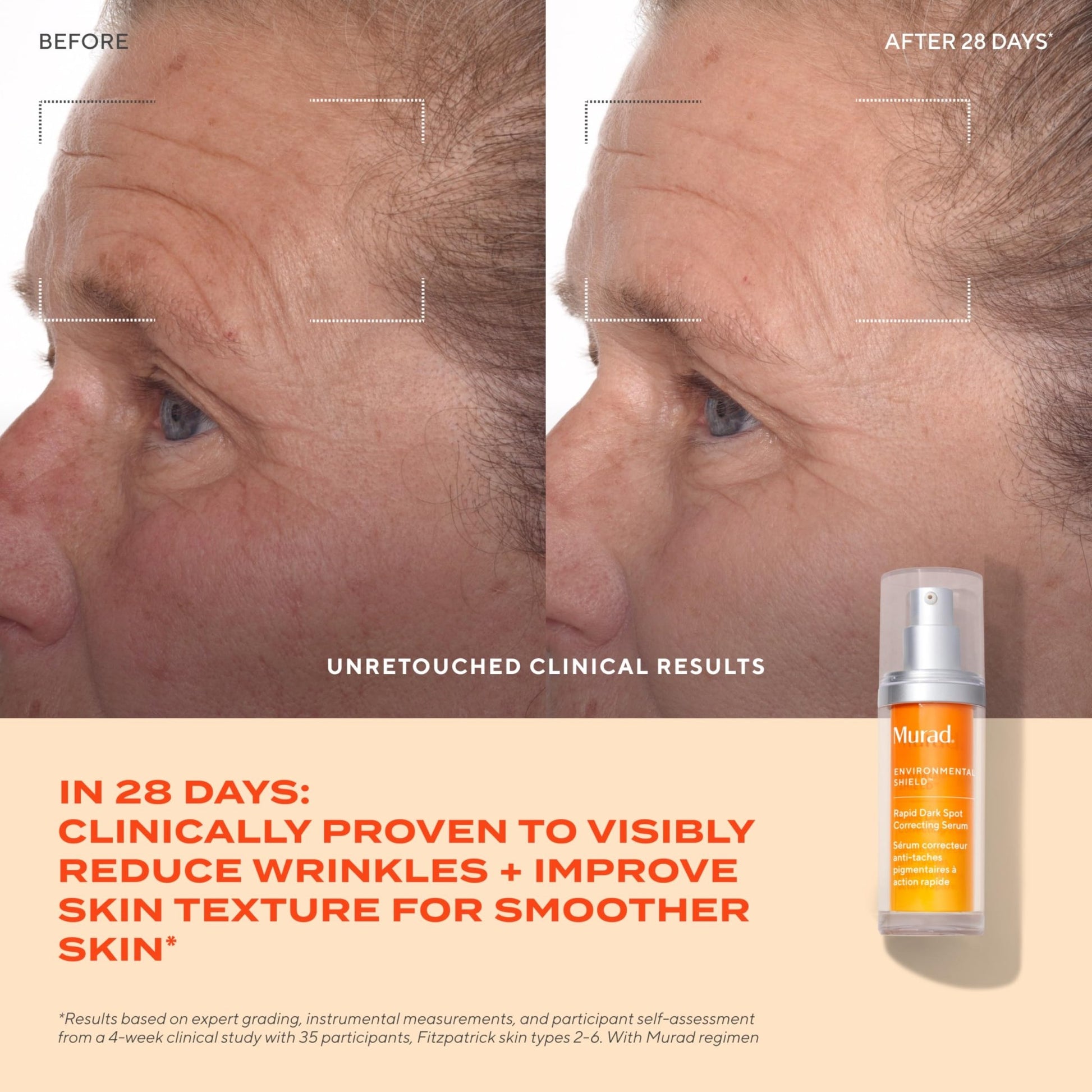 Murad Rapid Dark Spot Correcting Serum - Advanced Anti-Aging Formula with Patented Resorcinol Technology, Tranexamic and Glycolic Acids for Hyperpigmentation - dailyvitalstore