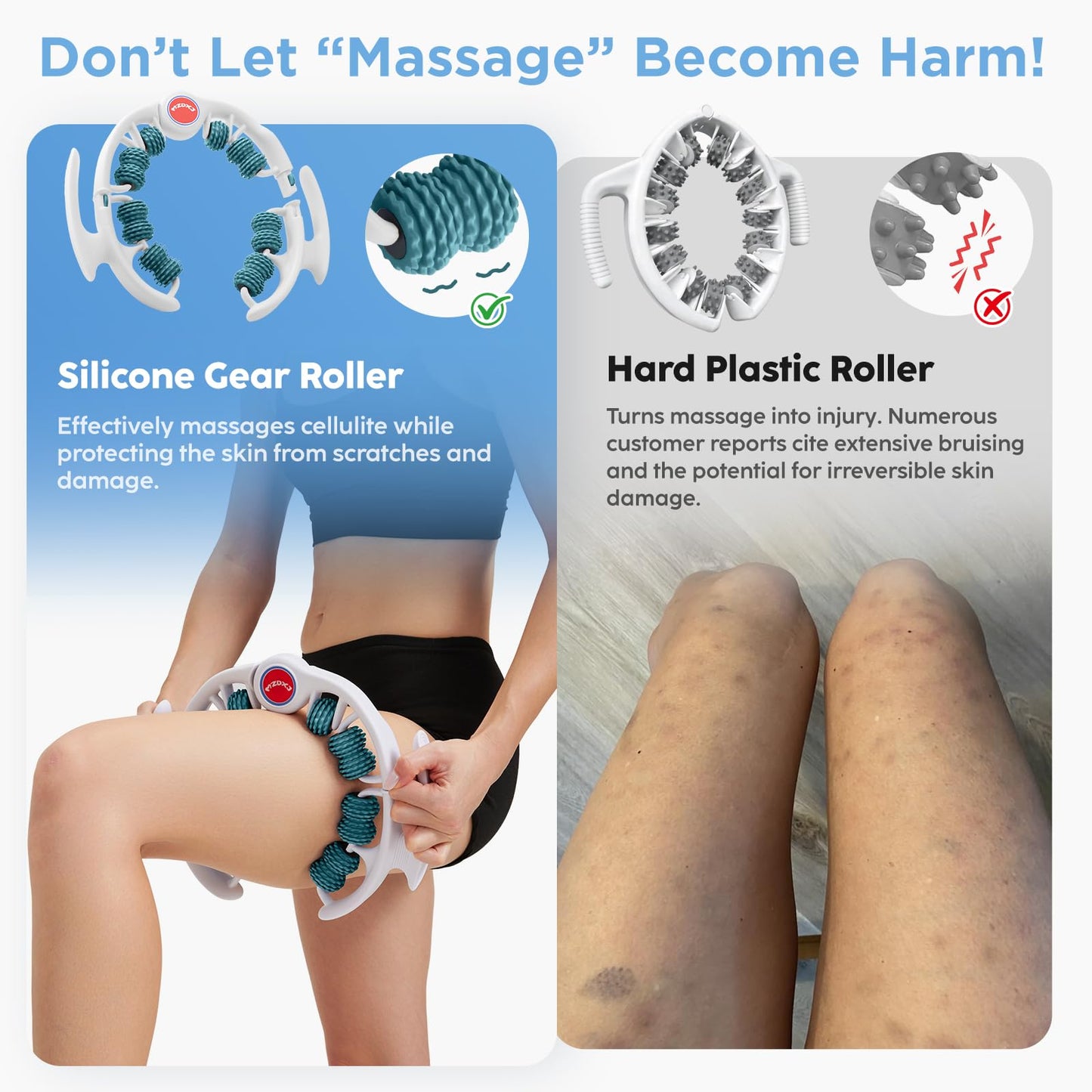 MZDXJ Cellulite Massage Tool - Lymphatic Drainage Massager - Muscle Roller, Deep Fascia Massage, Dimpled Skin Removal, Legs/Thighs/Buttocks, Anti-Cellulite Roller, Smooth Skin (14 Wheel - Green) - dailyvitalstore