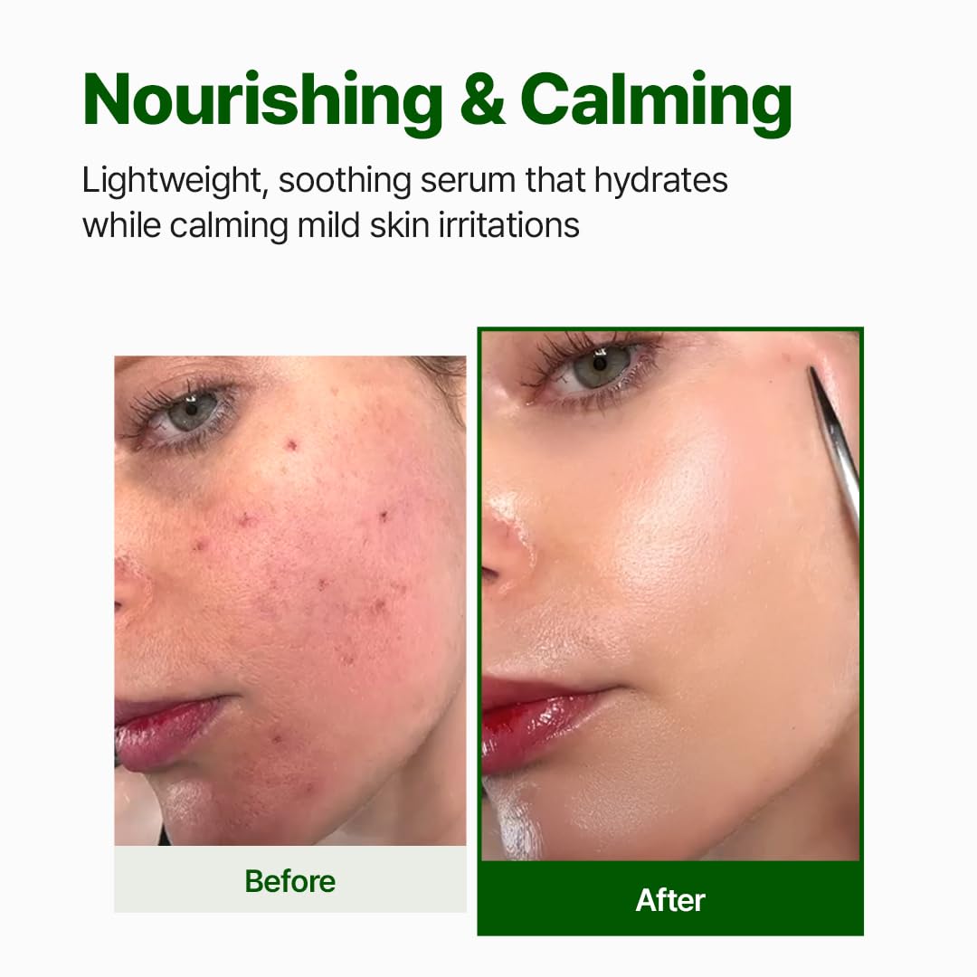 NACIFIC Cica PDRN Centella Serum (Centella Ampoule) 1.69 fl oz / 50ml, Korean Serum for Sensitive Skin, Calming & Hydrating - dailyvitalstore