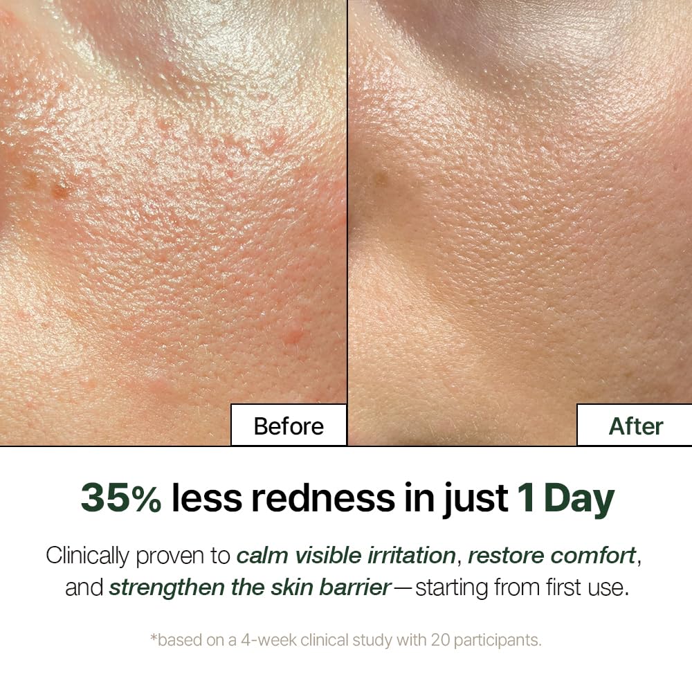 NATURAL DERMA PROJECT NDP Cica Cream - Gel Face Moisturizer for Sunburn Relief, lightweight Korean Moisturizer for Sensitive Skin, Centella Asiatica, - dailyvitalstore