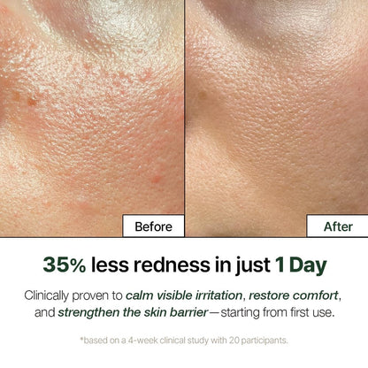 NATURAL DERMA PROJECT NDP Cica Cream - Gel Face Moisturizer for Sunburn Relief, lightweight Korean Moisturizer for Sensitive Skin, Centella Asiatica, - dailyvitalstore