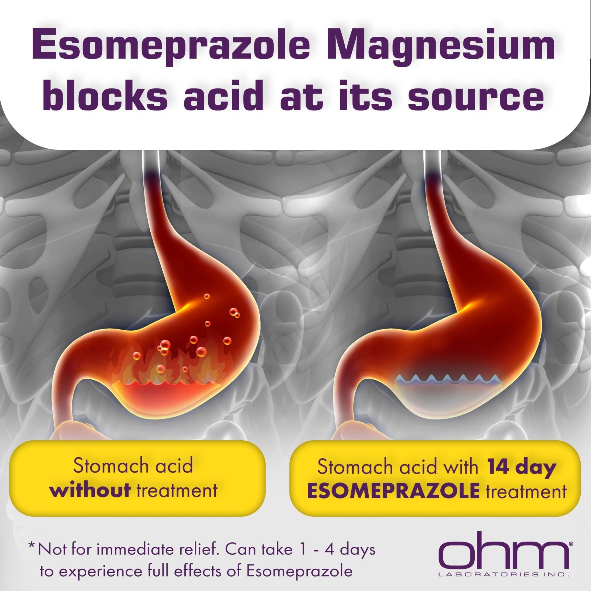 Ohm Esomeprazole Magnesium Delayed Release Capsules 20mg - Frequent Heartburn & Acid Reflux Relief, 24 Hour Chest & Stomach Acid Reducer (6 Weeks of Supply, 42, Count) - dailyvitalstore