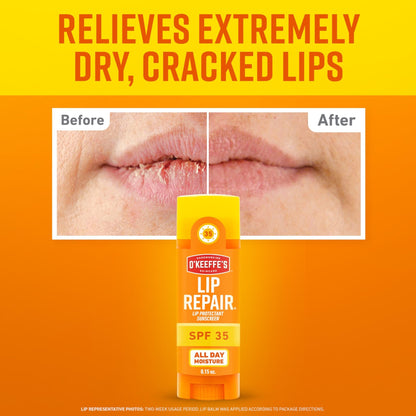 O'Keeffe's Lip Repair SPF 35 Lip Balm - Stick (3 Pack) - Sun-Safe Moisturizer for Extremely Cracked, Dry Lips - dailyvitalstore