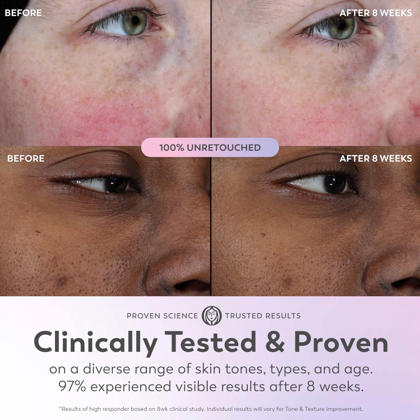 Olay Super Serum - Glow Serum for Face - Activated Niacinamide, Vitamin C & E, Collagen Peptide, AHA - 5-in-1 Benefits - Brightens, Hydrates, Smooths, - dailyvitalstore