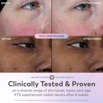 Olay Super Serum - Glow Serum for Face - Activated Niacinamide, Vitamin C & E, Collagen Peptide, AHA - 5-in-1 Benefits - Brightens, Hydrates, Smooths, Firms, Evens Tone, Proactive Anti-Aging, 1.7 Oz - dailyvitalstore