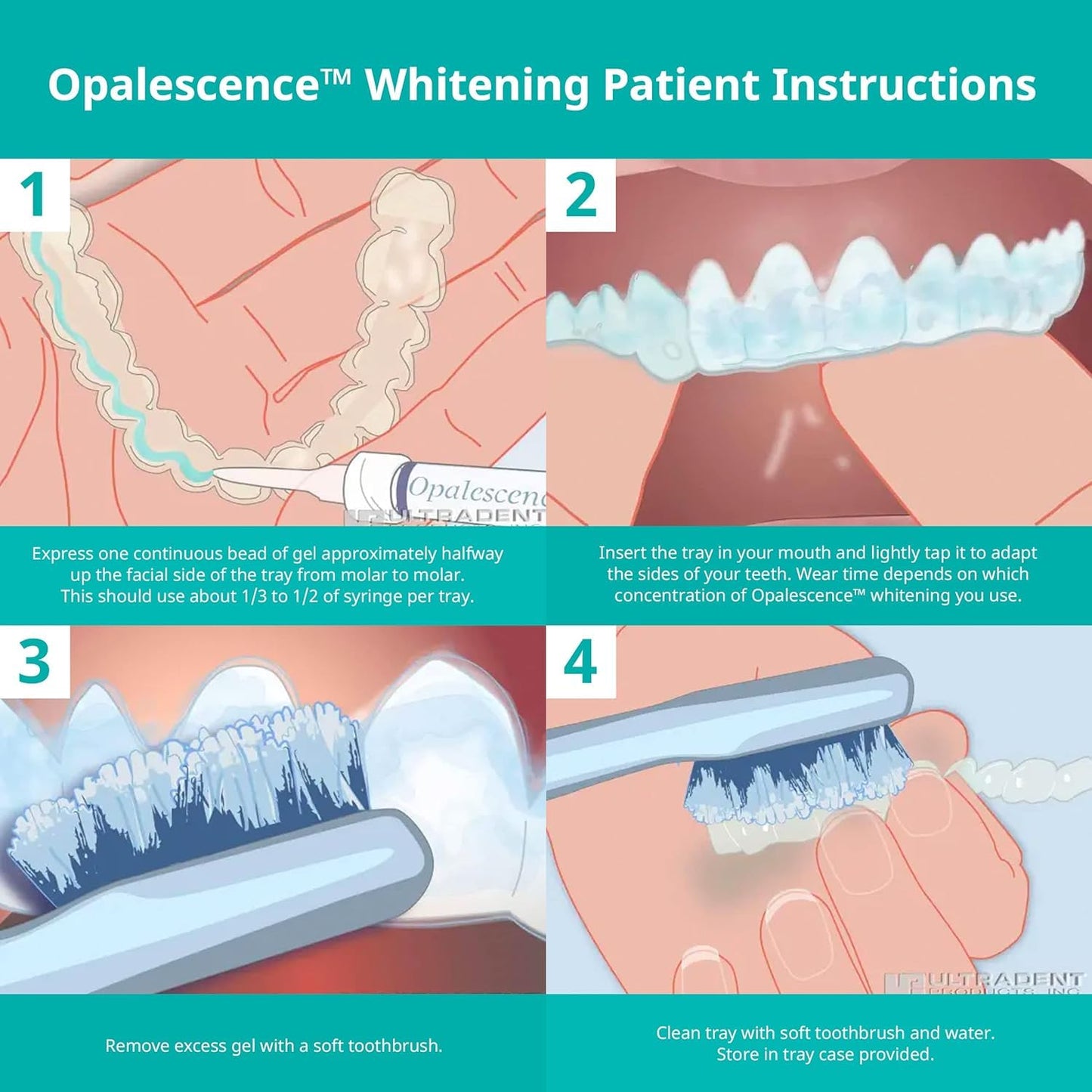 Opalescence 35% CP Mint - Gel Syringes Teeth Whitening - Refill Kit - Carbamide Peroxide Gel. Made by Ultradent - dailyvitalstore