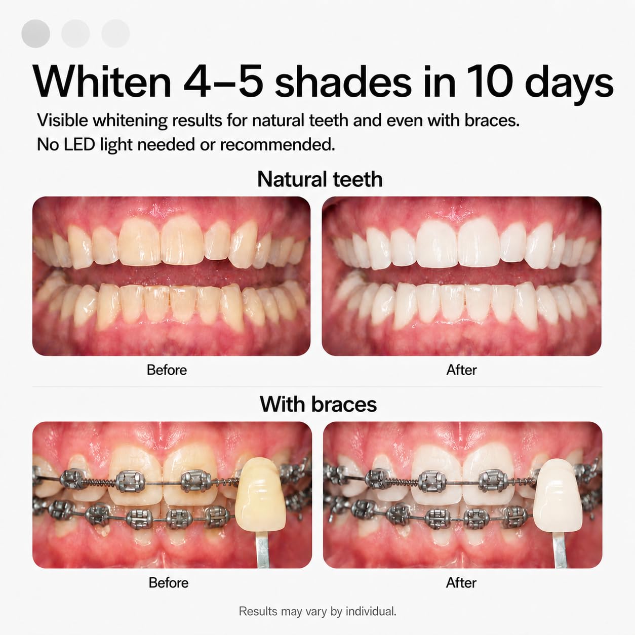 Opalescence Go 15- Prefilled Teeth Whitening Trays Kit - 15% Hydrogen Peroxide - (10 Treatments) Dentist Recomended - Made by Ultradent Products - dailyvitalstore