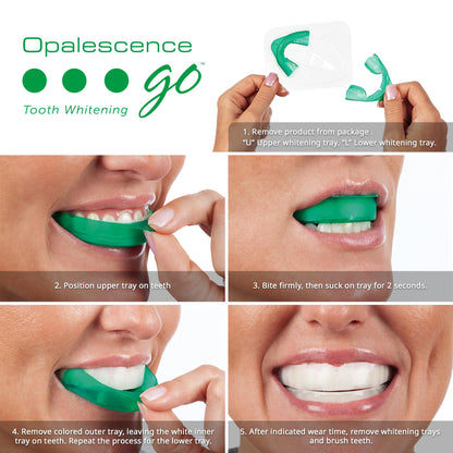 Opalescence Go 15- Prefilled Teeth Whitening Trays Kit - 15% Hydrogen Peroxide - (10 Treatments) Dentist Recomended - Made by Ultradent Products - dailyvitalstore