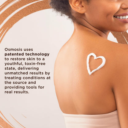 OSMOSIS Skin Aid Daily Supplement, Microbiome and Immunity Support, Vitamin A, for Acne and Blemish Prone Skin, 90 Count - dailyvitalstore
