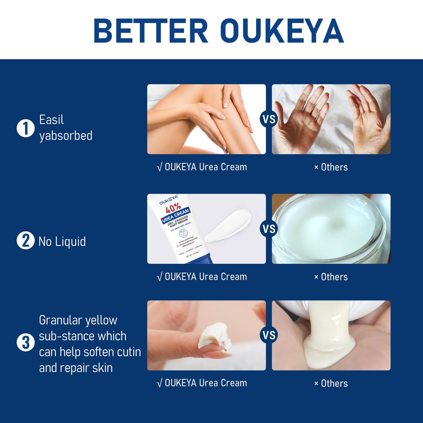 OUKEYA Urea Cream 40 Percent Tube 3 Oz, Foot & Hand Cream for Dry Cracked, 40 per Urea Lotion for Feet Maximum Strength - dailyvitalstore