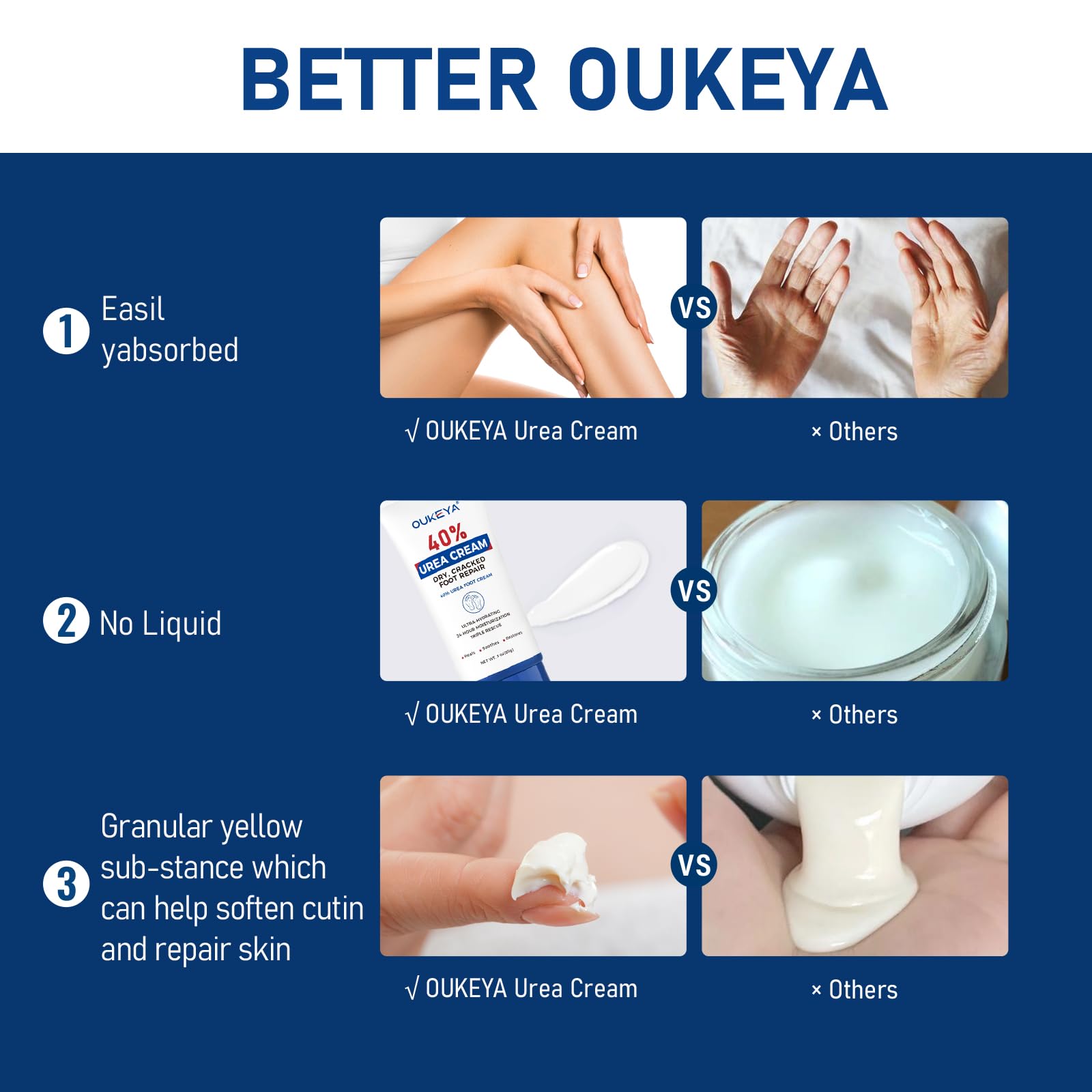 OUKEYA Urea Cream 40 Percent Tube 3 Oz, Foot & Hand Cream for Dry Cracked, 40 per Urea Lotion for Feet Maximum Strength - dailyvitalstore