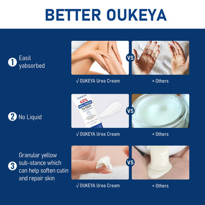 OUKEYA Urea Cream 40 Percent Tube 3 Oz, Foot & Hand Cream for Dry Cracked, 40 per Urea Lotion for Feet Maximum Strength - dailyvitalstore