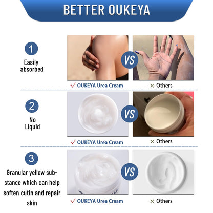 OUKEYA Urea Cream 40 Percent,Foot & Hand Cream for Dry Cracked,Urea Lotion for Feet Maximum Strength - dailyvitalstore
