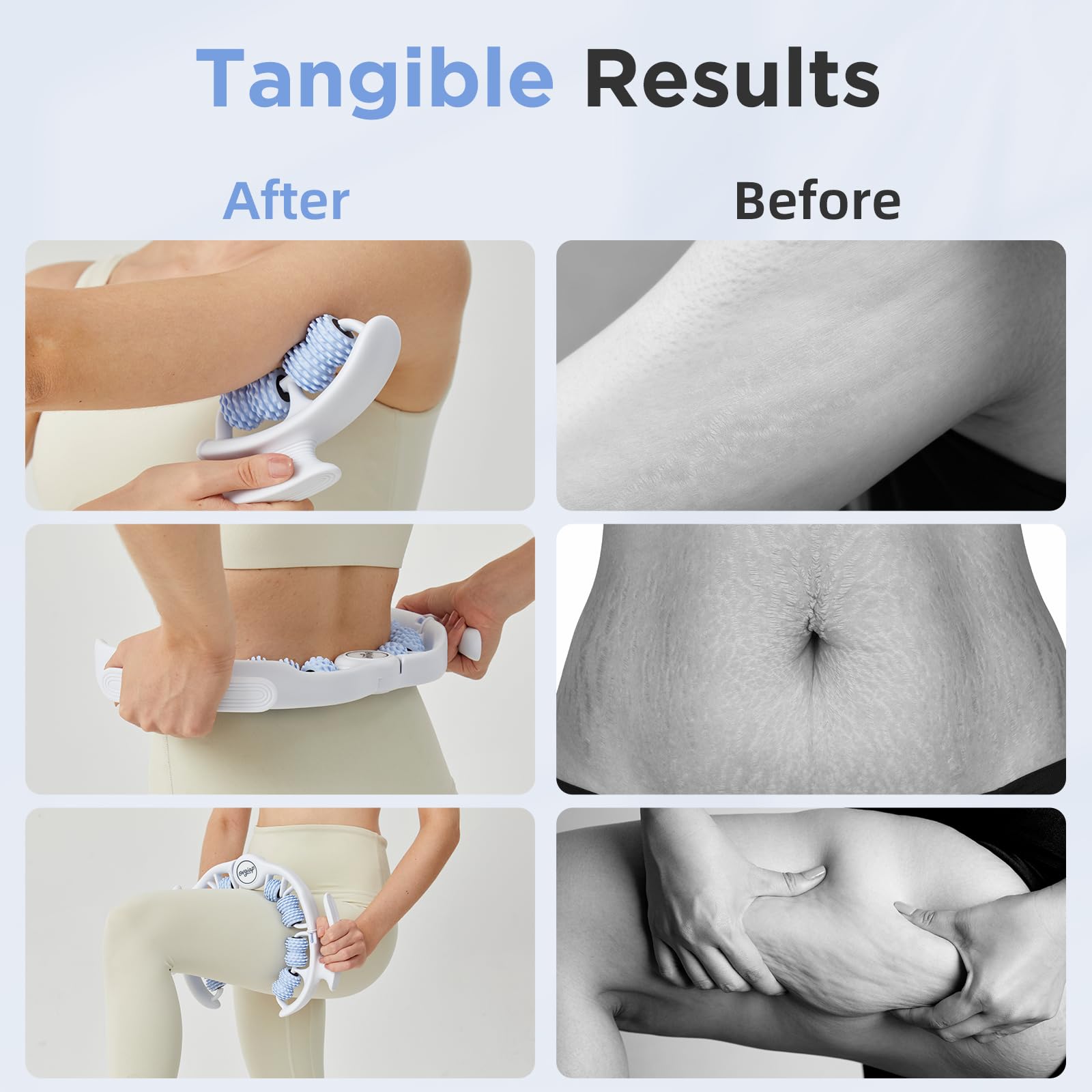 OVGIAP Cellulite Manual Massager for Legs & Thighs - Lymphatic Drainage Tool, Handheld Fascia Blaster for Deep Tissue, Body Sculpting Cellulite Remover(Blue) - dailyvitalstore