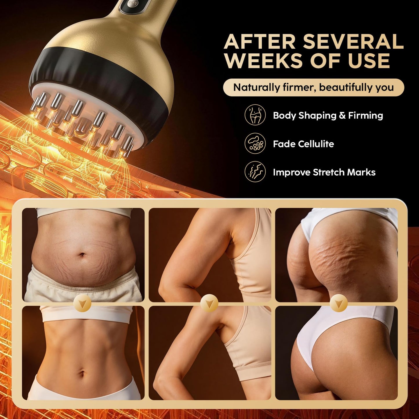 OVGIAP Lymphatic Drainage Massager & Anti-Cellulite Massage Tool, Body Sculpting Device for Legs, Arms & Stomach, Supports Smoother Skin, with Gentle Warming & Vibration - Gold - dailyvitalstore