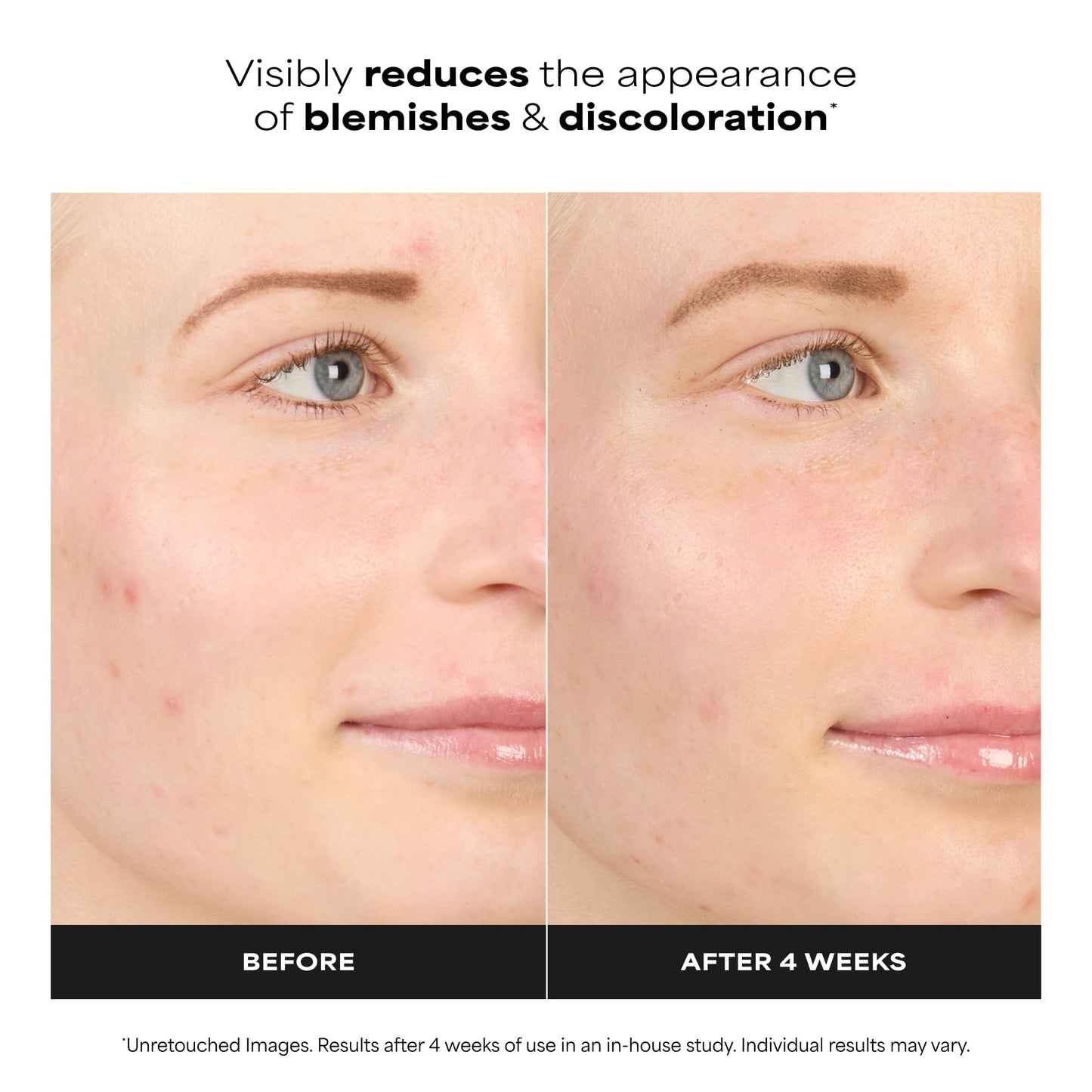 Paula’s Choice BOOST 10% Azelaic Acid Booster Cream Gel, Oil-Free Serum Fades Discoloration & Post-Blemish Marks, with Licorice Extract - dailyvitalstore