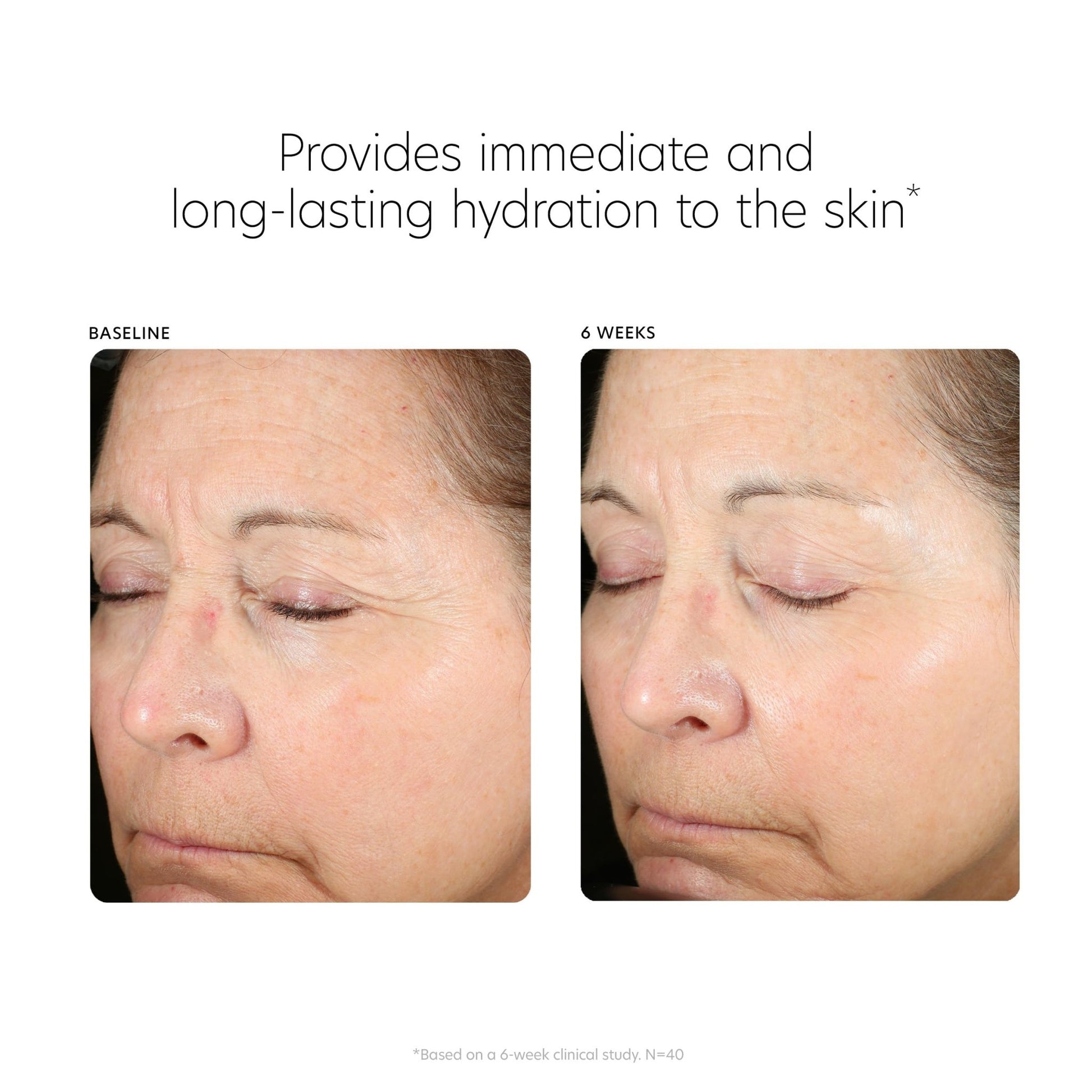 PCA SKIN Hyaluronic Acid Boosting Face Serum, Hyaluronic Acid Serum for Face Made with Niacinamide and Ceramides, Helps Reduce Fine Lines and Wrinkles - dailyvitalstore