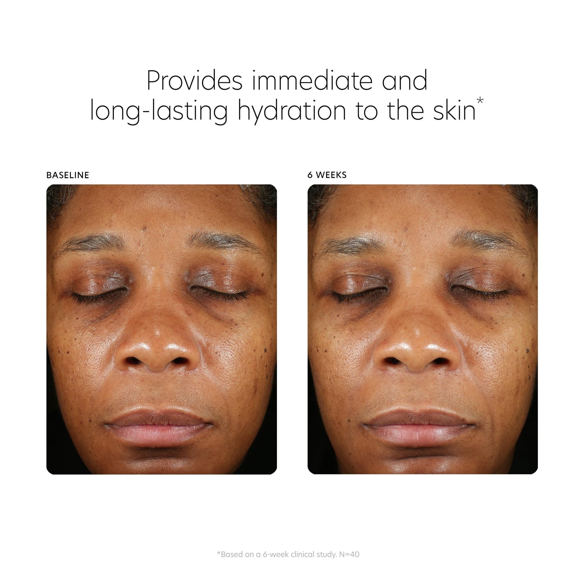 PCA SKIN Hyaluronic Acid Boosting Face Serum, Hyaluronic Acid Serum for Face Made with Niacinamide and Ceramides, Helps Reduce Fine Lines and Wrinkles - dailyvitalstore
